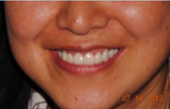 After Image