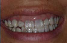 Before Image